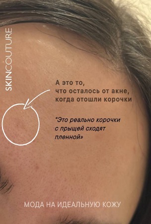 Ожидание 10 минут